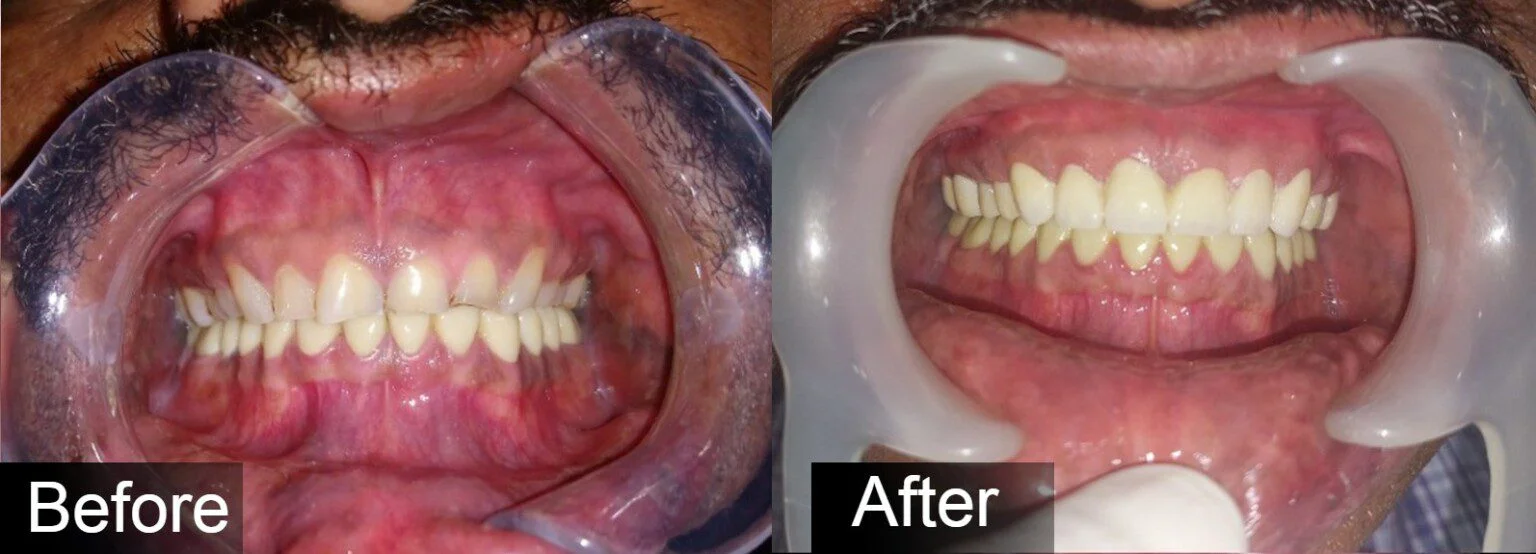Before After Case Section 2