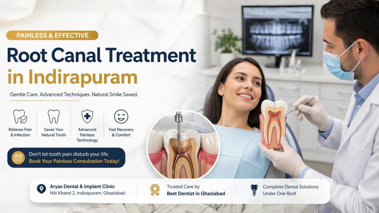 Painless Root Canal Treatment Indirapuram | Best Dentist in Ghaziabad