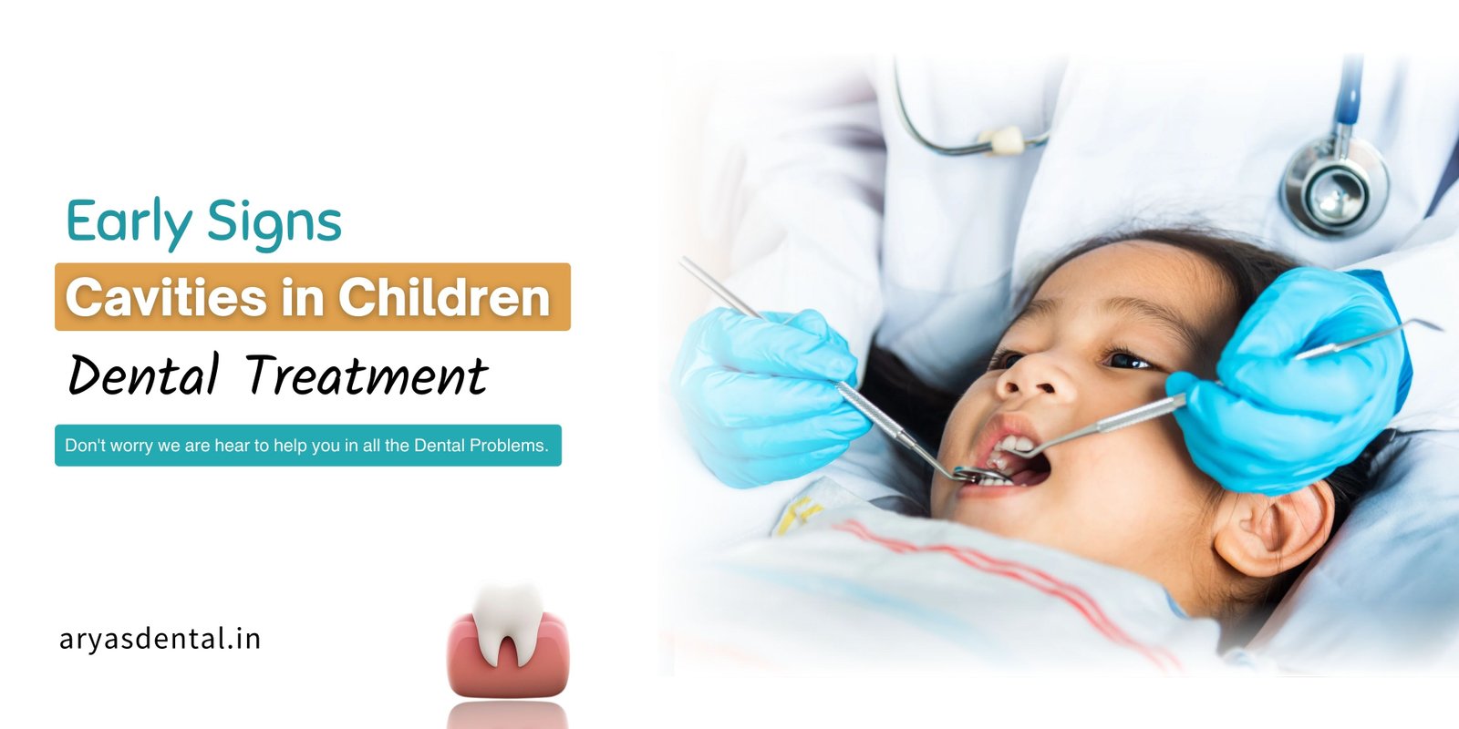 early-signs-of-cavities-in-children-dental-cavities-treatment-in-ghaziabad