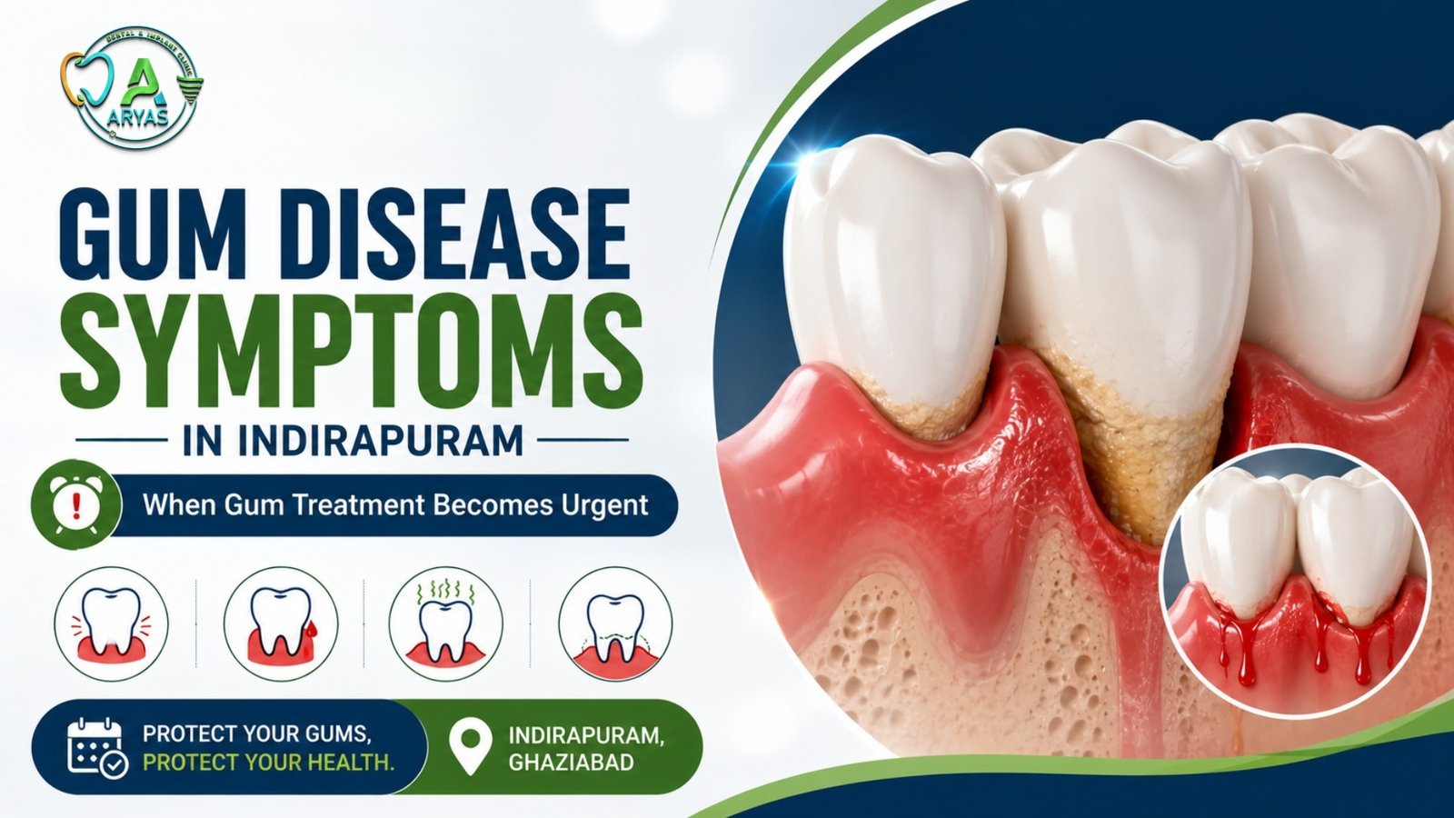 Gum Treatment in Indirapuram: Symptoms & When It Becomes Urgent