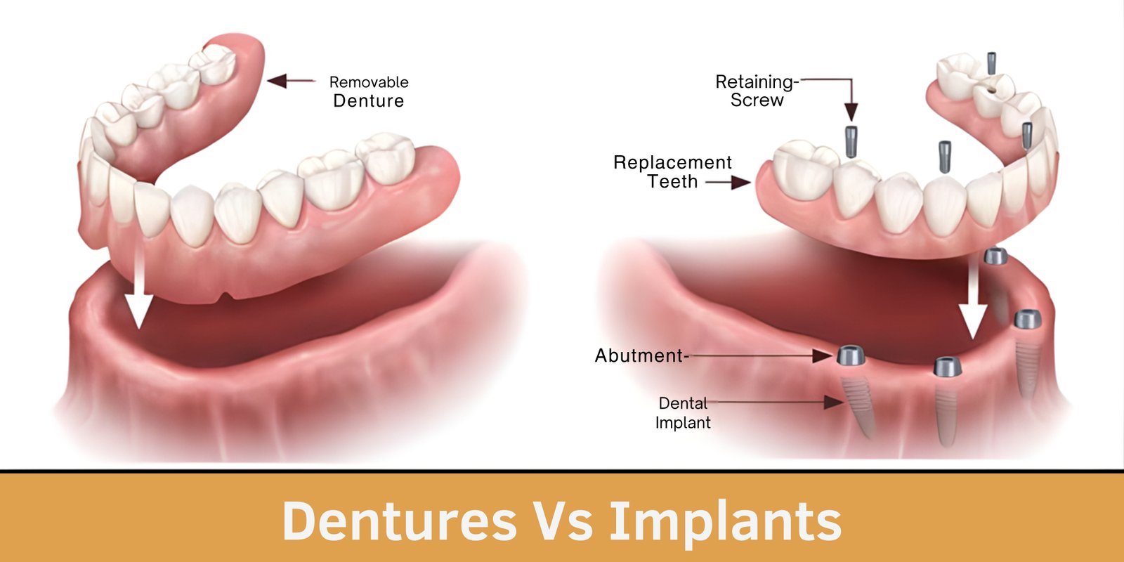 best-dentist-ghaziabad-root-canal-treatment-indirapuram-aryas-dental-clinic