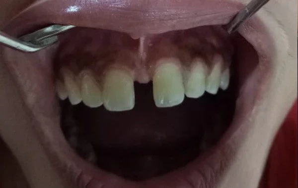 Dental Treatment Image 1