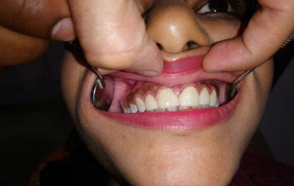 Dental Treatment Image 2