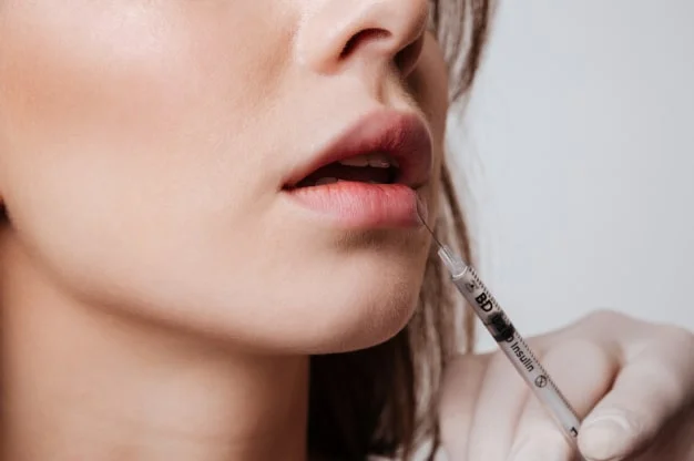 Facial filler treatment